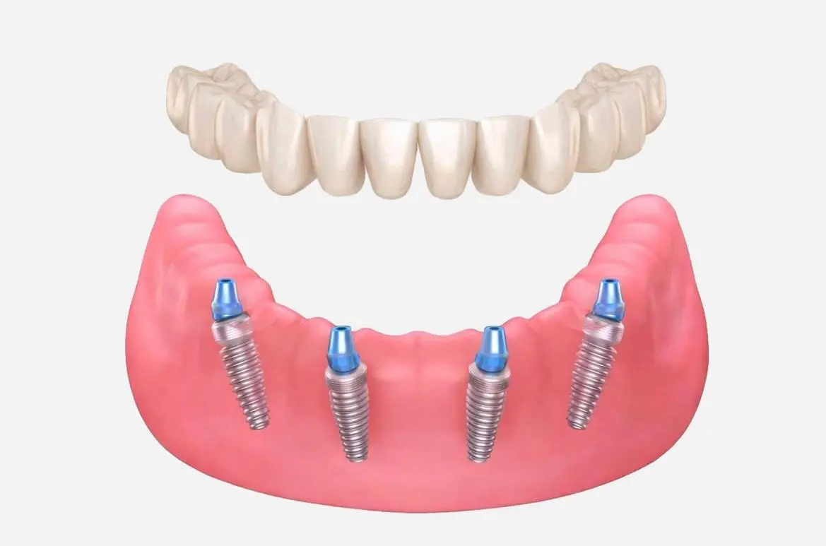 Radiografia dentale e strumentazione clinica